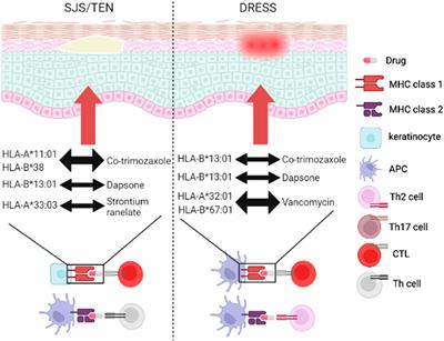 Current understanding of genetic associations with delayed hypersensitivity reactions induced by antibiotics and anti-osteoporotic drugs